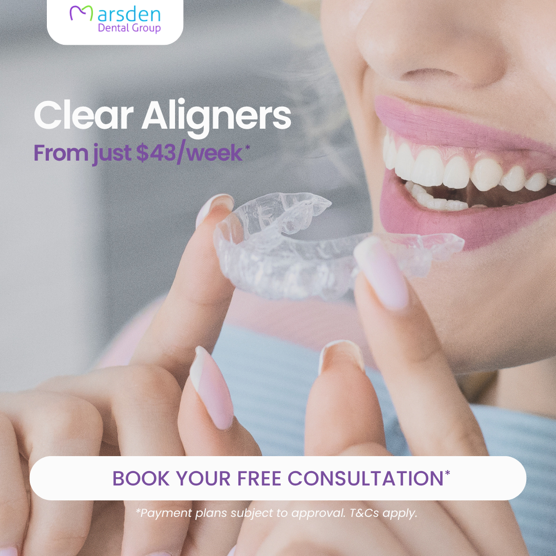 Clear Aligners Website banner