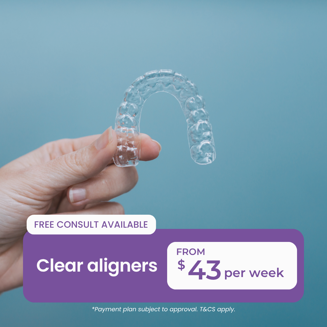 Clear Aligners