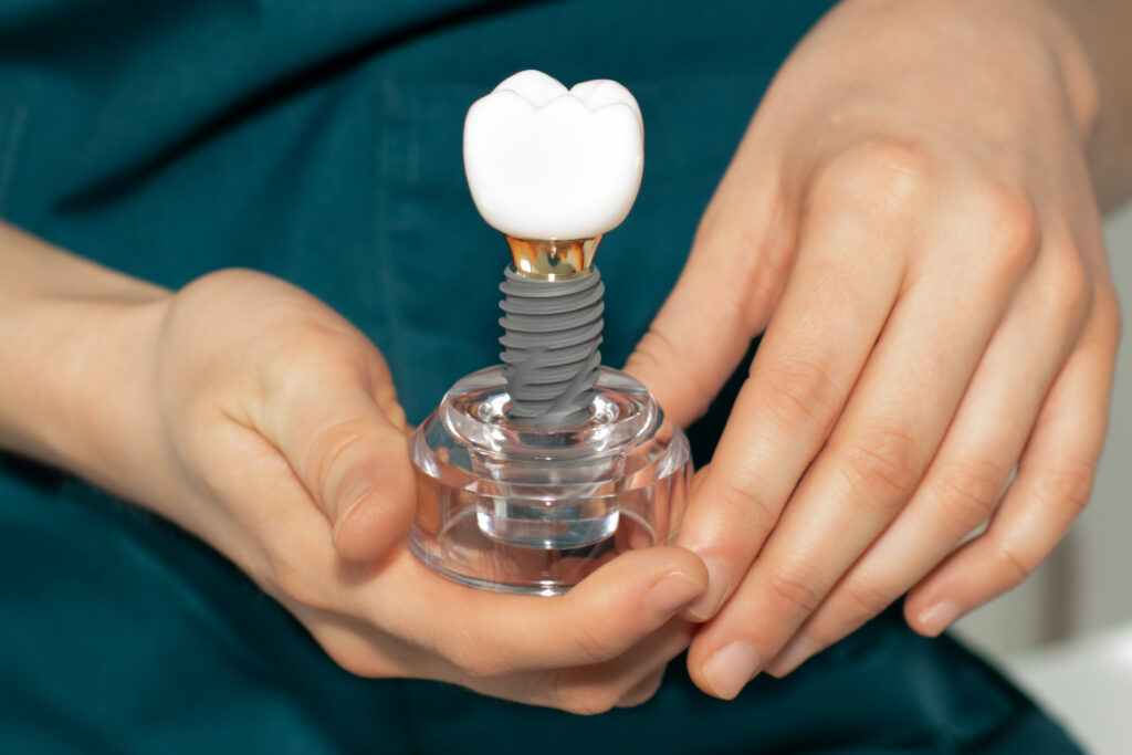 dental implant marsden dental dental implant dentist marsden